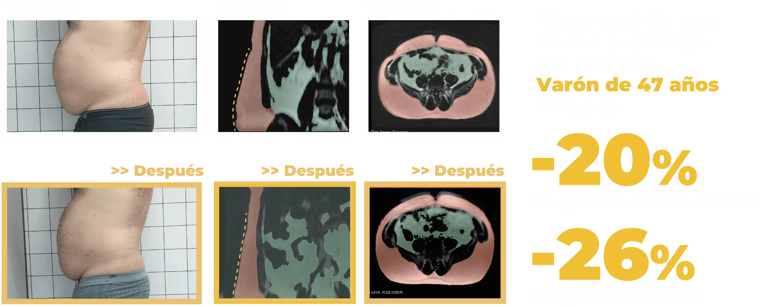 Equipo Drakarian de radiofrecuencia médica en Riva Medic
